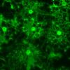 Myelin producing brain cells called oligodendrocytes appear vivid green in this enhanced image.  They were created in Dr. Paul Tesar's lab at Case Western Reserve University from skin fibroblast cells. They're testing whether these cells can replace myelin in the brain lost to diseases like MS and cerebral palsy.